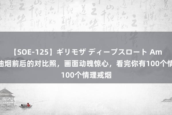 【SOE-125】ギリモザ ディープスロート Ami 18张抽烟前后的对比照，画面动魄惊心，看完你有100个情理戒烟