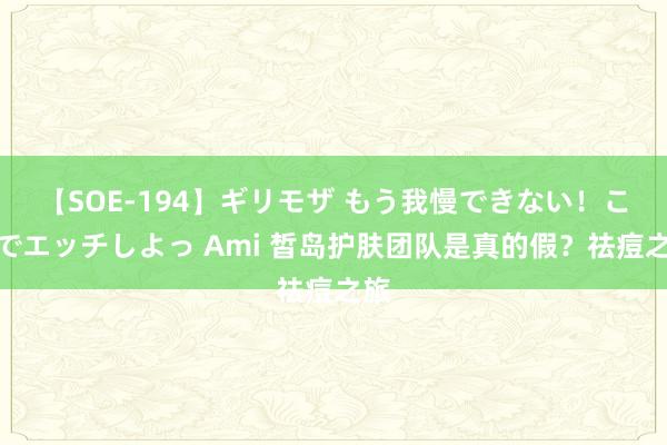 【SOE-194】ギリモザ もう我慢できない！ここでエッチしよっ Ami 皙岛护肤团队是真的假？祛痘之旅